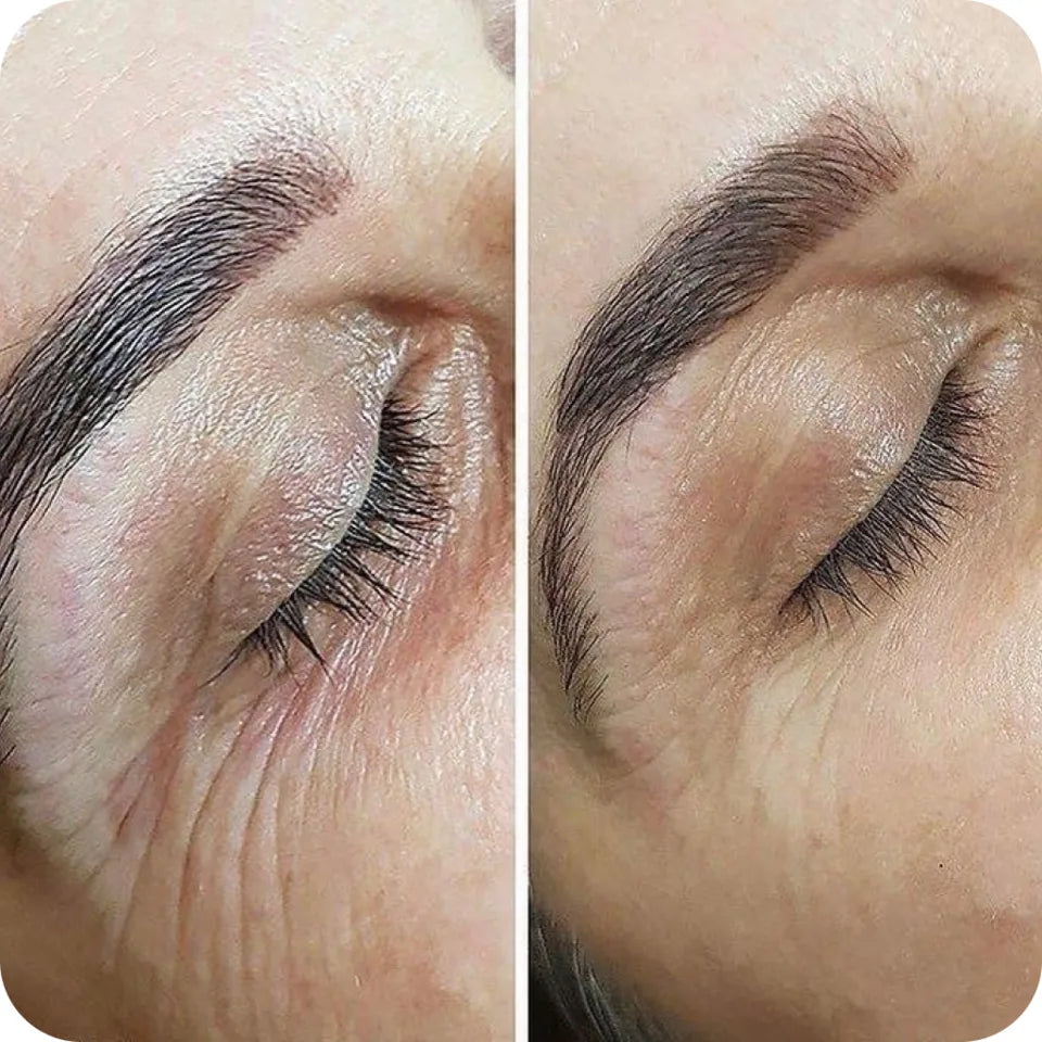 Before-and-after brow detail showing a fuller shaped eyebrow result